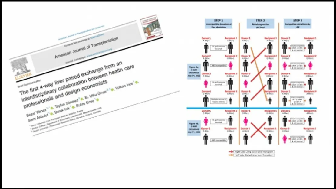 En ileri çapraz karaciğer nakli modeli dünya basınında