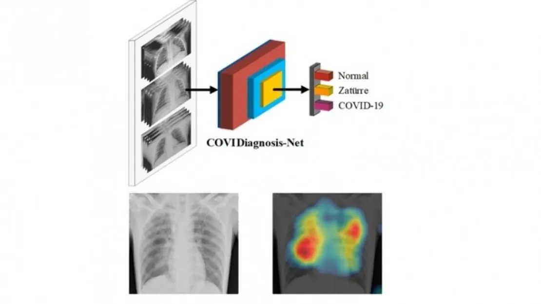 Koronavirüsün hızlı teşhisine yapay zeka sistemi