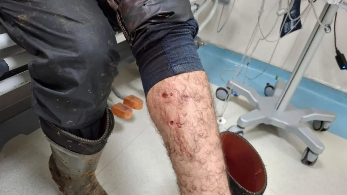 Veteriner hekim aşılama sırasında köpek saldırısına uğradı