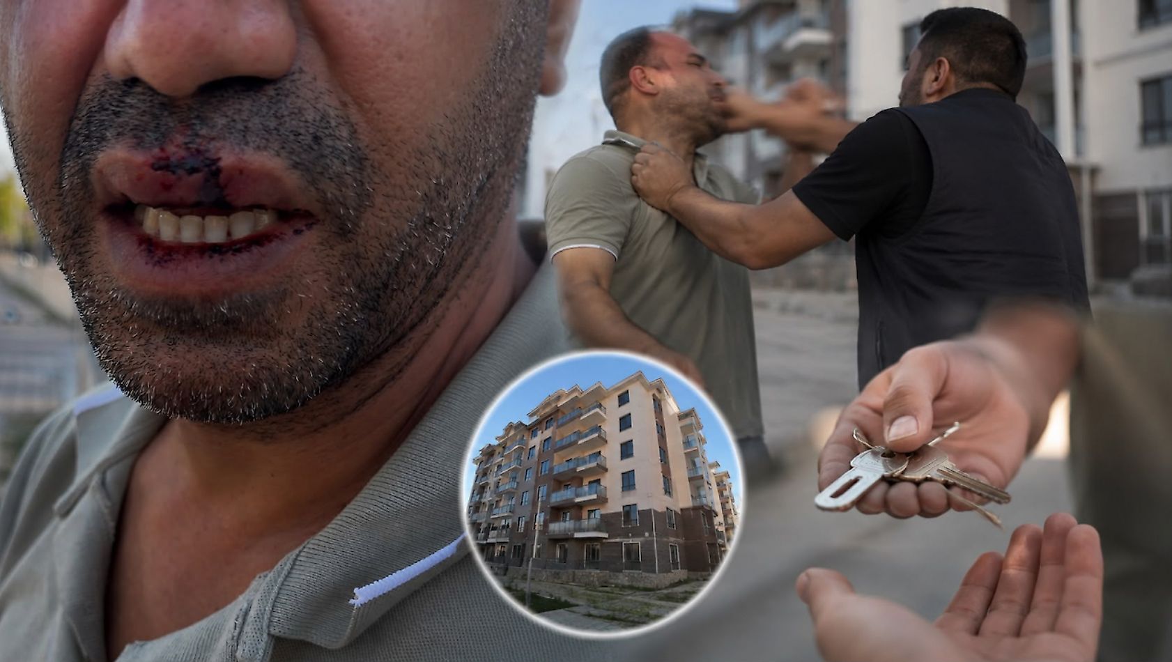 Rezerv Alanda Anahtar ve Eksik Tartışması: Vatandaş Hastanelik Oldu