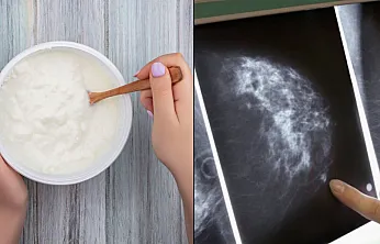 Bilim insanları meme kanseri ile bakteriyel iltihaplanma arasındaki olası ilişkiyi araştırdı