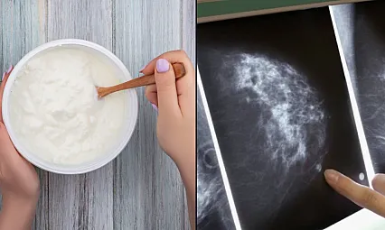 Bilim insanları meme kanseri ile bakteriyel iltihaplanma arasındaki olası ilişkiyi araştırdı