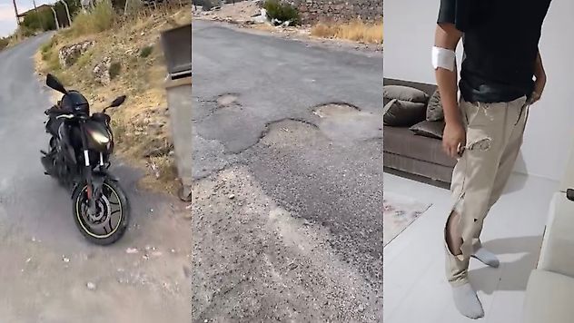 'Bugün Benim Başıma Geldi, Yarın Daha Ağır Kaza Olabilir'