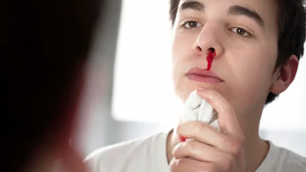 Sıcak havalarda burun kanamaları nedenlerine dikkat!