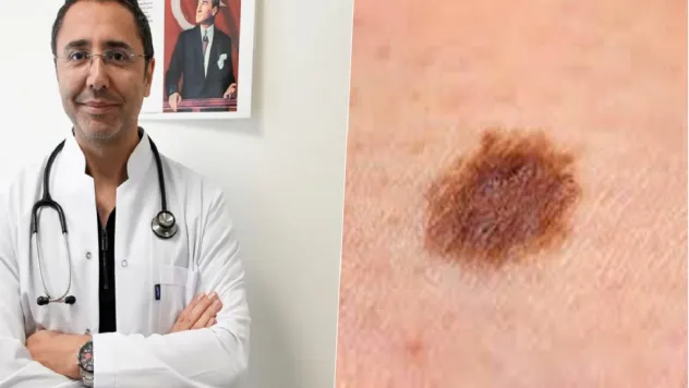 Uzmandan cilt kanseri uyarısı