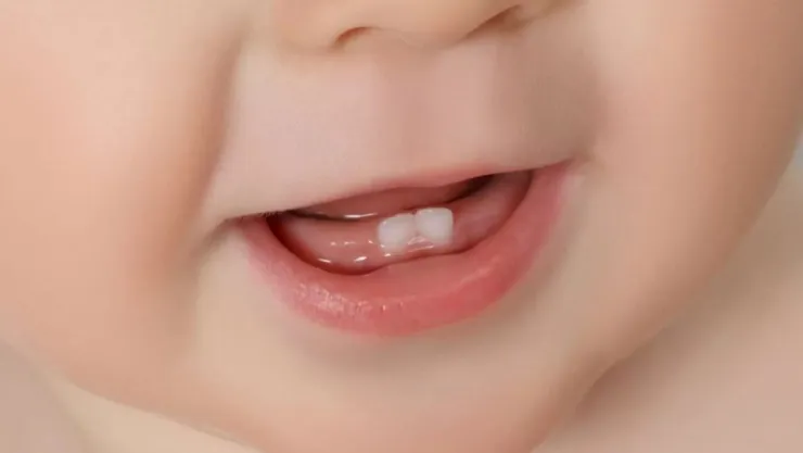 Diş çıkarma döneminde dikkat edilmesi gerekenler