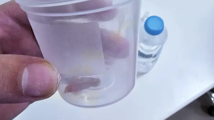 Dr. Ömer Emre Aşkın'dan kritik teşhis: Öksürüğün nedeni yabancı cisim