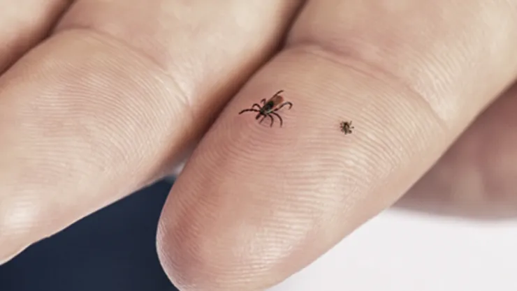 Kayseri'de kene kaynaklı bir ölüm daha