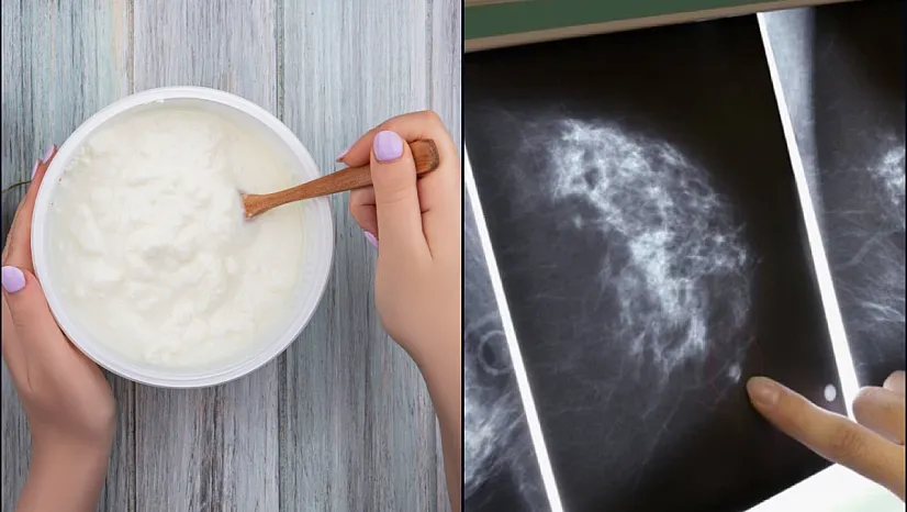 Bilim insanları meme kanseri ile bakteriyel iltihaplanma arasındaki olası ilişkiyi araştırdı