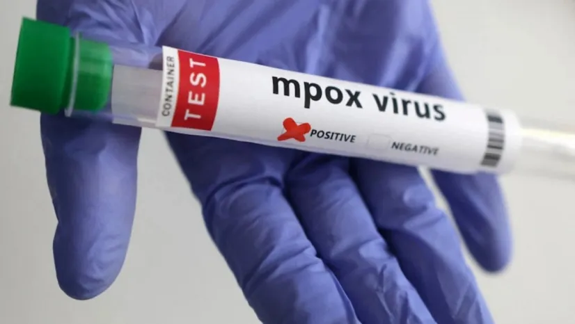 Bir Yıl Süren Uyarı Sona Erdi: Mpox Acil Durumu Kapatıldı