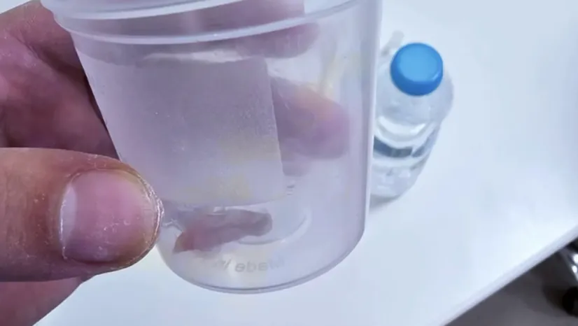 Dr. Ömer Emre Aşkın'dan kritik teşhis: Öksürüğün nedeni yabancı cisim