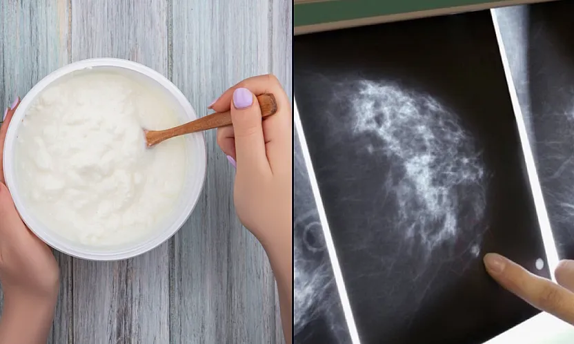 Bilim insanları meme kanseri ile bakteriyel iltihaplanma arasındaki olası ilişkiyi araştırdı